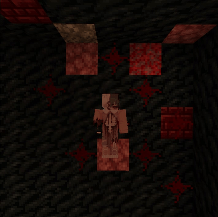 Well... What can I say about this poor guy? Well... I just feel sorry for him. He still talks, moves, and "lives," if I can put it that way. This guy should have been dead a long time ago, but the moment his soul left his body he came here, and well... Sad