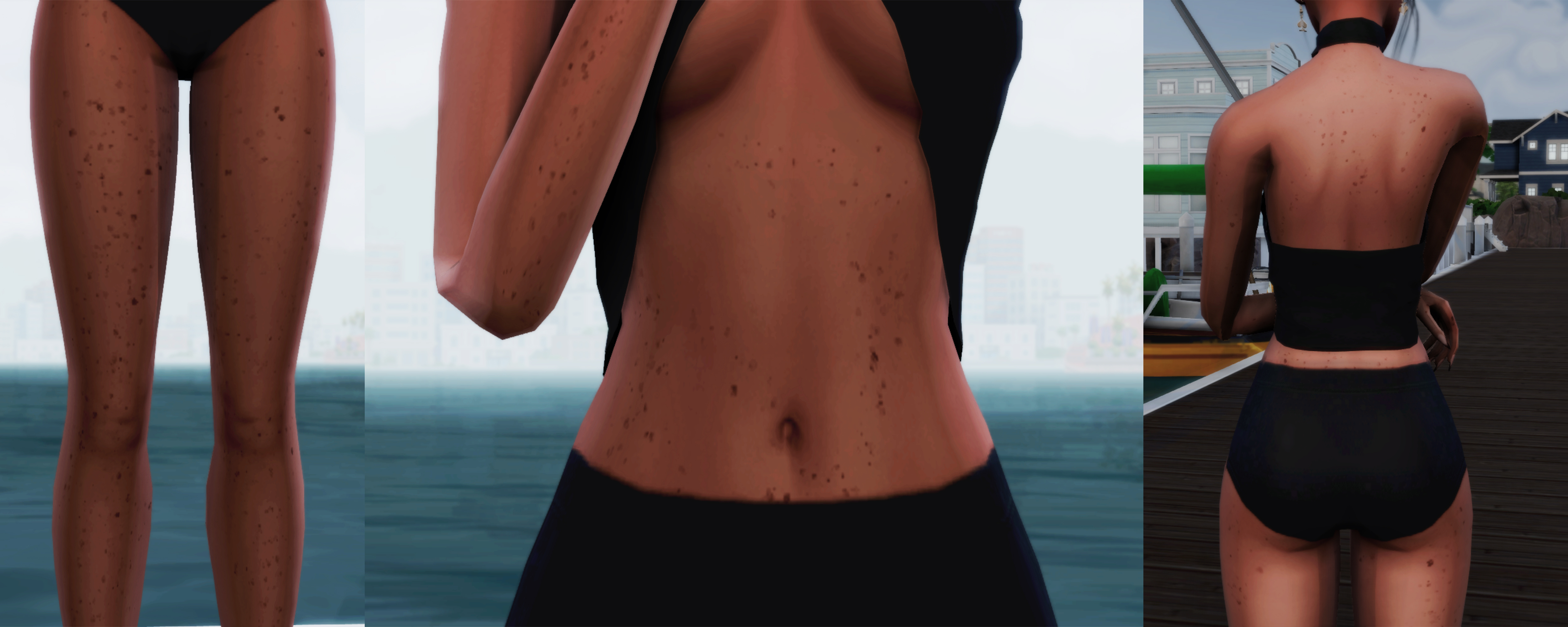 Freckles