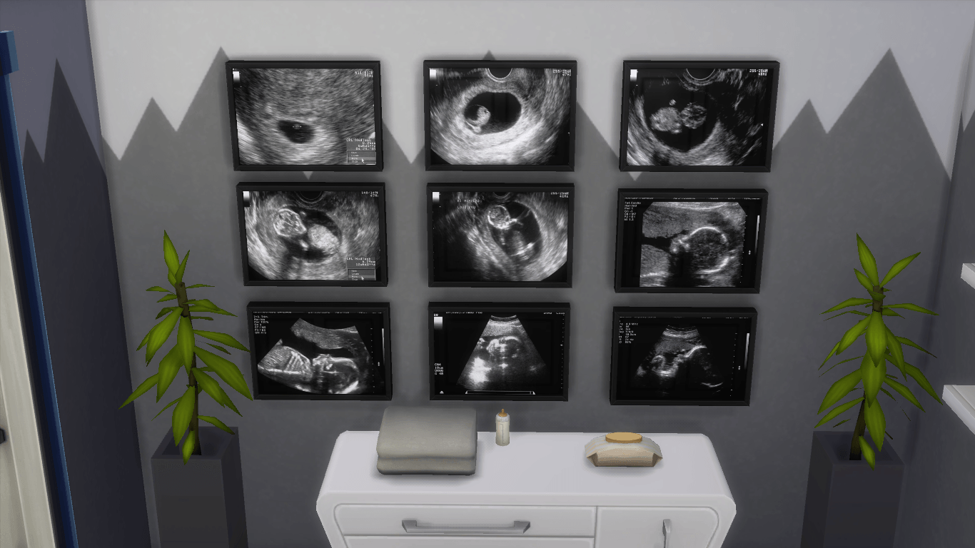 Stages of Pregnancy Ultrasounds Wall Art - The Sims 4 Build / Buy ...