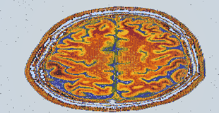 Brain