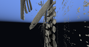 Spine
