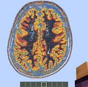 Super brain