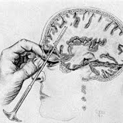 Lobotomy Archive logo