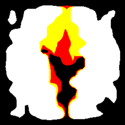 Torchrism logo