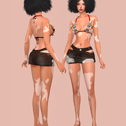 Vitiligo All Ages Eden logo