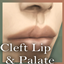 Cleft Lip and Palate Scar Born Defect logo