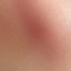 Acineto Blush V2 (Narrow) logo
