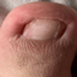 TheFatToe project image