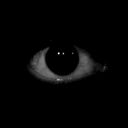 Elder Eye project image