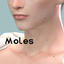Moles set logo