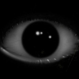 The Eye