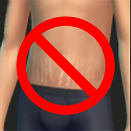 Stretchmarks Disabler logo